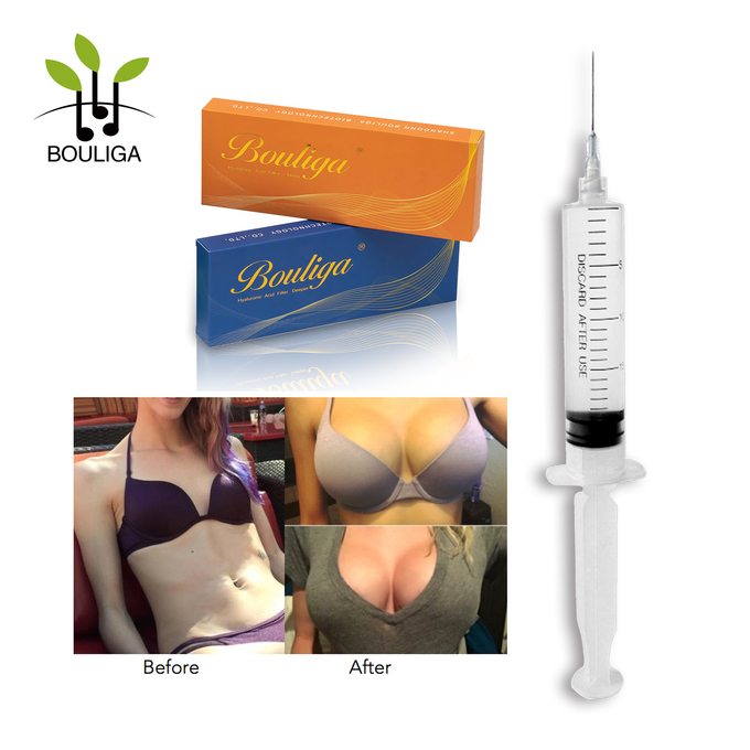 20mg/Ml - 30mg/Ml Non Surgical Breast Augmentation Fillers Crosslinked HA