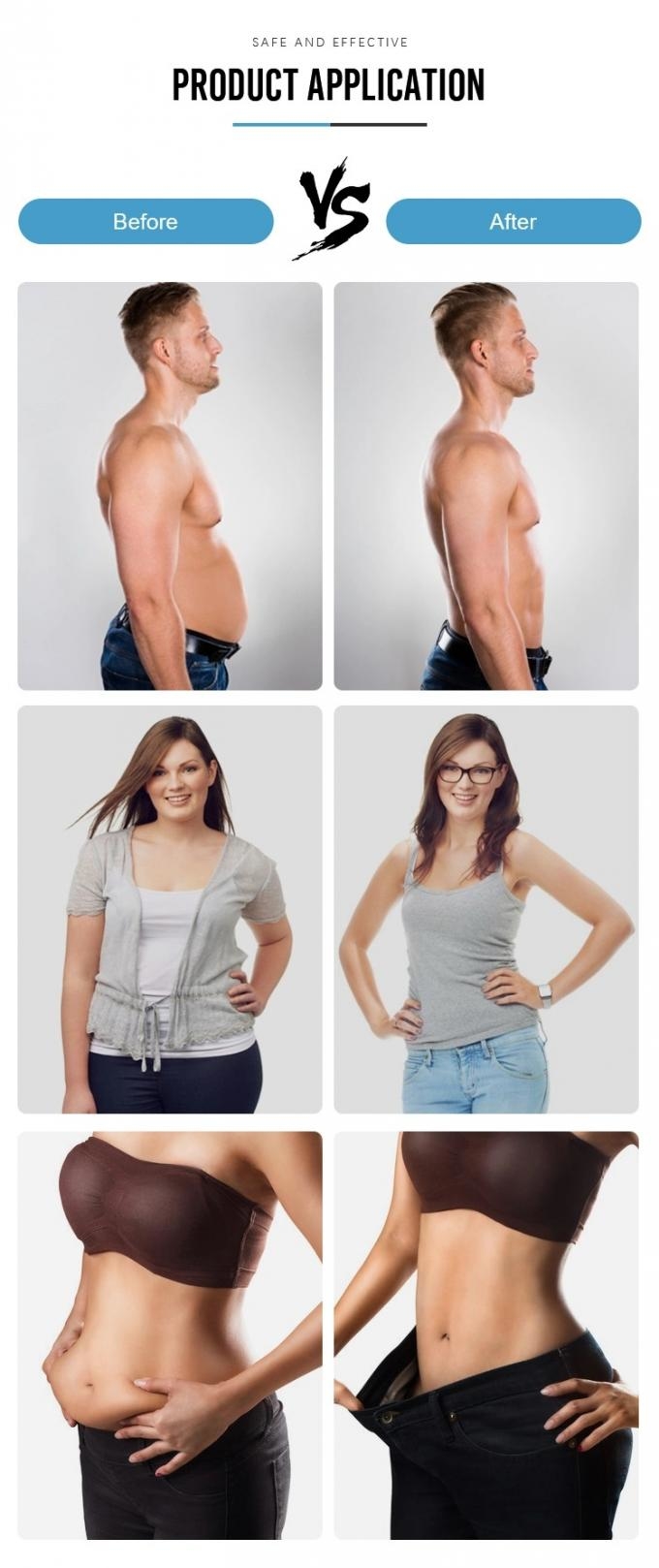 lipolisys solution before and after