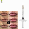 OdM Injectable Hyaluronic Acid Dermal Filler 2ml For Lip Augmentation