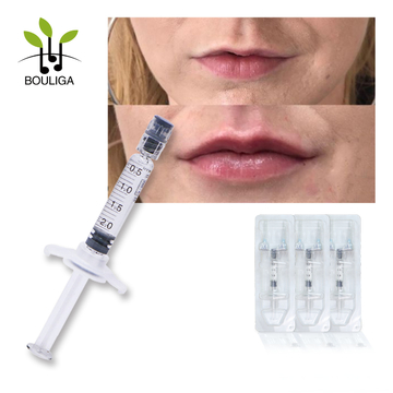 Bouliga cross linked Hyaluronic Acid Dermal Filler Injection 2ml Derm line for lips