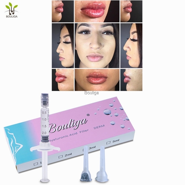Bouliga Cross linked Hyaluronic Acid Filler 2ml dermal filler Derm line for love lips