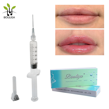 Bouliga Dermal Filler Customizable 5ml Cross Linked Hyaluronic Acid Filler Amazing Price