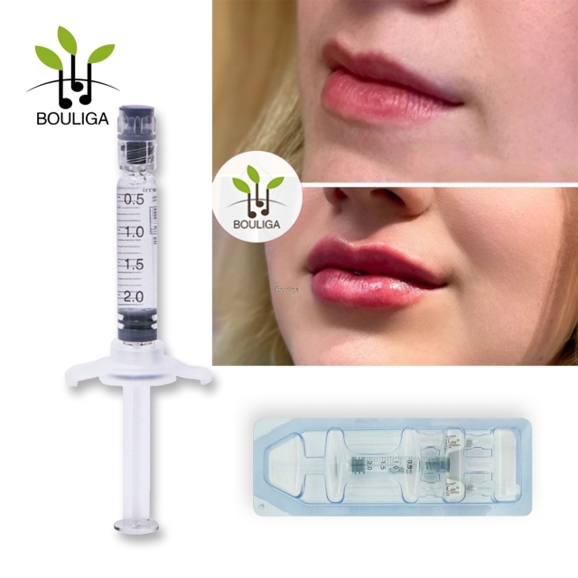 2ml Lips Dermal Filler Monophasic Cross Linked Hyaluronic Acid Filler For Lip