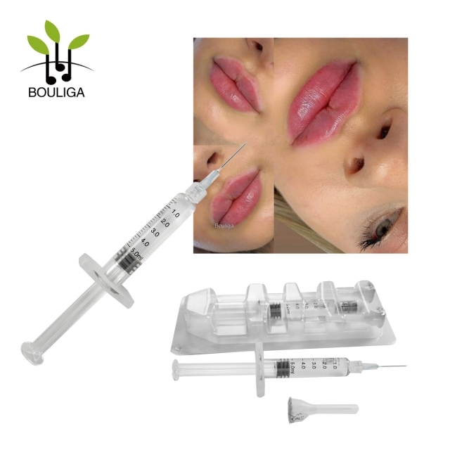 Bouliga Hyaluronic Acid Wrinkle Fillers Lip 5ml Cross Linked HA