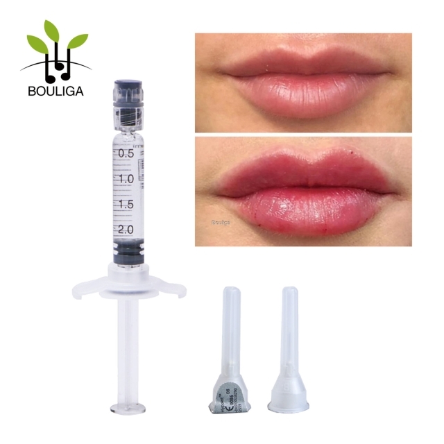 ha injections,hyaluronic acid dermal filler for lip enchance