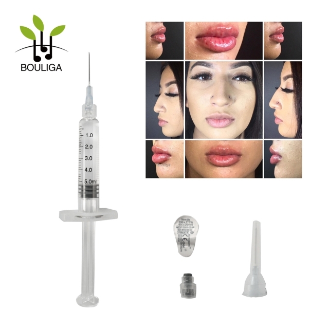 5ml 20mg/Ml HA Hyaluronic Acid Dermal Filler Crosslinked For Anti aging