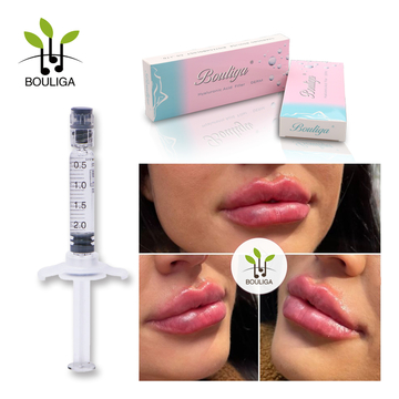 Bouliga Injectable Hyaluronic Acid Dermal Filler Gel 2ml Derm Line Cross Linked For Lips